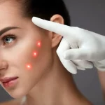 چرا انتخاب تجهیزات جوانسازی برای کلینیک‌های تازه‌کار اهمیت دارد؟