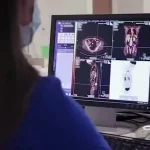 چرا موارد سرطان تیروئید در جهان رو به افزایش است؟ + فیلم